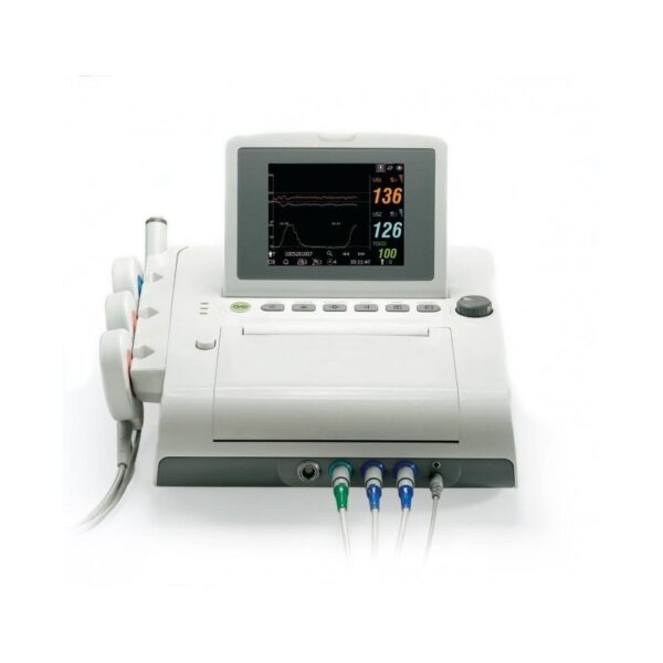 Monitor fetal